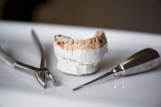 תיקון שיניים תותבות במחירים נוחים